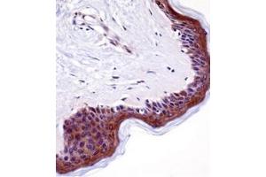 Immunohistochemistry analysis in formalin fixed and paraffin embedded human skin tissue reacted with LSM14A Antibody (C-term) followed which was peroxidase conjugated to the secondary antibody and followed by DAB staining. (LSM14A antibody  (C-Term))