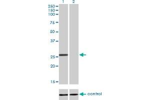 Western blot analysis of BCAS2 over-expressed 293 cell line, cotransfected with BCAS2 Validated Chimera RNAi (Lane 2) or non-transfected control (Lane 1).