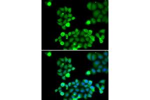 Immunofluorescence analysis of HeLa cells using NEIL1 antibody (ABIN5973442). (NEIL1 antibody)