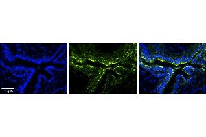 Rabbit Anti-PLOD2 Antibody     Formalin Fixed Paraffin Embedded Tissue: Human Bronchial Epithelial Tissue  Observed Staining: Cytoplasmic  Primary Antibody Concentration: 1:100  Secondary Antibody: Donkey anti-Rabbit-Cy3  Secondary Antibody Concentration: 1:200  Magnification: 20X  Exposure Time: 0. (PLOD2 antibody  (Middle Region))