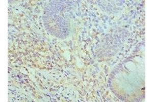 Immunohistochemistry (IHC) image for anti-SWI/SNF Related, Matrix Associated, Actin Dependent Regulator of Chromatin, Subfamily C, Member 2 (SMARCC2) (AA 300-650) antibody (ABIN7171057)