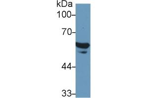 Detection of FGB in Human Serum using Polyclonal Antibody to Fibrinogen Beta Chain (FGB) (Fibrinogen beta Chain antibody  (AA 29-118))