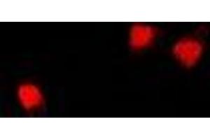 Immunofluorescent analysis of U2AF65 staining in U2OS cells. (U2AF2 antibody)