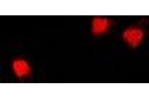 Immunofluorescent analysis of U2AF65 staining in U2OS cells.
