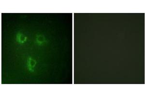 Immunofluorescence analysis of HUVEC cells, using TMEPA antibody. (PMEPA1 antibody  (Internal Region))