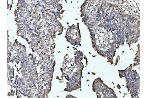 IHC analysis of RRP4/EXOSC2 using anti-RRP4/EXOSC2 antibody (ABIN7602188). (EXOSC2 antibody  (AA 62-293))