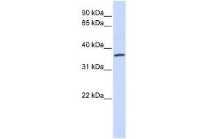 CCR5 antibody used at 5 ug/ml to detect target protein.