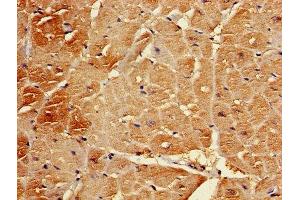 Immunohistochemistry of paraffin-embedded human heart tissue using ABIN7145367 at dilution of 1:100 (B3GALT2 antibody  (AA 201-422))