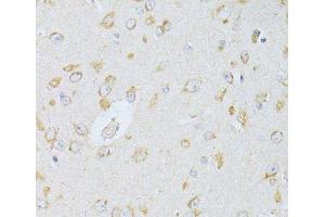 Immunohistochemistry of paraffin-embedded Rat brain using NTS Polyclonal Antibody at dilution of 1:100 (40x lens). (Neurotensin antibody)
