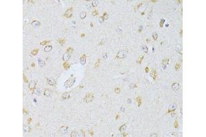 Immunohistochemistry of paraffin-embedded Rat brain using NTS Polyclonal Antibody at dilution of 1:100 (40x lens).