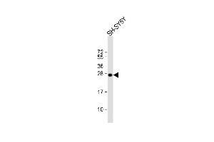 Anti-SN Antibody (Center) at 1:1000 dilution + SH-SY5Y whole cell lysate Lysates/proteins at 20 μg per lane. (SNAP25 antibody  (AA 36-63))