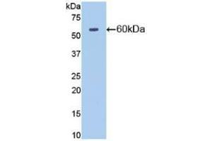 Detection of Recombinant NT5E, Mouse using Polyclonal Antibody to Cluster Of Differentiation 73 (CD73) (CD73 antibody  (AA 29-550))