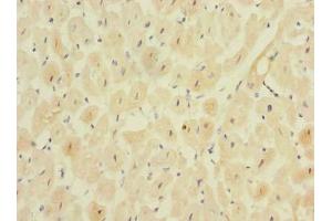Immunohistochemistry of paraffin-embedded human heart tissue using ABIN7159469 at dilution of 1:100 (MPPED1 antibody  (AA 1-326))