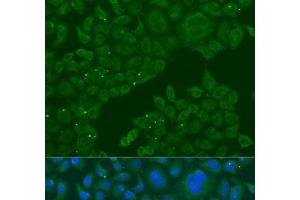 B3GALNT1 antibody