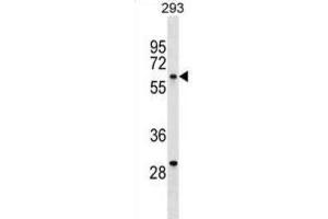 Western Blotting (WB) image for anti-V-Yes-1 Yamaguchi Sarcoma Viral Oncogene Homolog 1 (YES1) antibody (ABIN3003458)