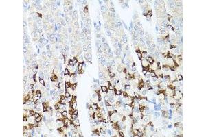 Immunohistochemistry of paraffin-embedded Mouse stomach using GPM6A Polyclonal Antibody at dilution of 1:100 (40x lens). (GPM6A antibody)