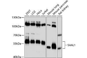 Western blot analysis of extracts of various cell lines, using S antibody (ABIN6133132, ABIN6147353, ABIN6147354 and ABIN6217085) at 1:3000 dilution. (SAAL1 antibody  (AA 175-474))