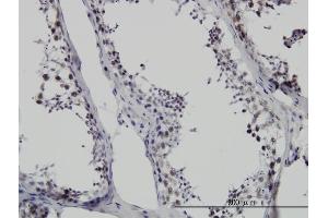 Immunoperoxidase of monoclonal antibody to SMNDC1 on formalin-fixed paraffin-embedded human testis. (SMNDC1 antibody  (AA 1-238))