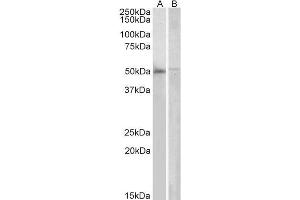ABIN184642 (2µg/ml) staining of Human Bone Marrow (A) and PBL (B) lysates (35µg protein in RIPA buffer). (DOK3 antibody  (C-Term))