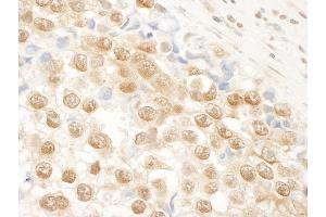 Immunohistochemistry (IHC) image for anti-N(alpha)-Acetyltransferase 15, NatA Auxiliary Subunit (NAA15) (AA 816-866) antibody (ABIN7448680) (NAA15 antibody  (AA 816-866))