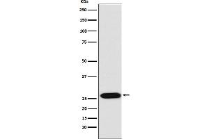 Western blot analysis of LIN28 expression in NCCIT cell lysate.