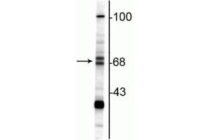 Western blot of rat hippocampal lysate showing specific immunolabeling of the ~68/70 kDa ChAT. (Choline Acetyltransferase antibody)