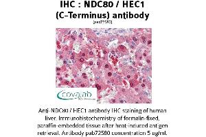 Image no. 2 for anti-NDC80 Kinetochore Complex Component Homolog (NDC80) (C-Term) antibody (ABIN1737233) (NDC80 antibody  (C-Term))