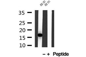 Western blot analysis of extracts of HEK-293 cells, using IFT20 antibody.