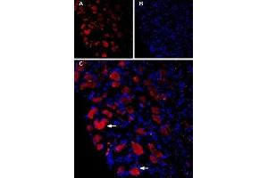 Immunohistochemistry (IHC) image for anti-Calcium Channel, Voltage-Dependent, L Type, alpha 1D Subunit (CACNA1D) (AA 859-875), (Intracellular) antibody (ABIN7043003)