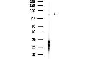 anti-Myosin Light Chain Kinase 3 (MYLK3) (Internal Region) antibody
