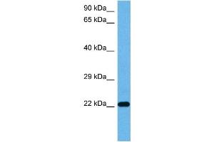 Host:  Mouse  Target Name:  TNNI3  Sample Tissue:  Mouse Pancreas  Antibody Dilution:  1ug/ml (TNNI3 antibody  (Middle Region))