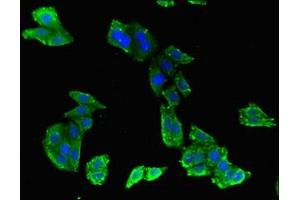 Immunofluorescent analysis of HepG2 cells using ABIN7144899 at dilution of 1:100 and Alexa Fluor 488-congugated AffiniPure Goat Anti-Rabbit IgG(H+L) (ABCB9 antibody  (AA 630-766))