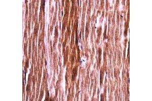 Akt2 antibody immunohistochemistry analysis in formalin fixed and paraffin embedded mouse skeletal muscle. (AKT2 antibody  (AA 93-122))