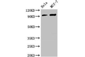 Western Blot Positive WB detected in: Hela whole cell lysate, MCF-7 whole cell lysate All lanes: TTC27 antibody at 2. (TTC27 antibody  (AA 590-817))
