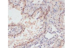 Immunohistochemistry of paraffin-embedded Rat lung using Phospho-PEA15(S104) Polyclonal Antibody at dilution of 1:100 (40x lens). (PEA15 antibody  (pSer104))