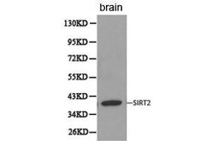 Western Blotting (WB) image for anti-Sirtuin 2 (SIRT2) antibody (ABIN1874785) (SIRT2 antibody)