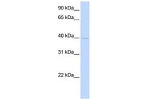Image no. 1 for anti-Tropomodulin 2 (TMOD2) (AA 36-85) antibody (ABIN6743795) (TMOD2 antibody  (AA 36-85))