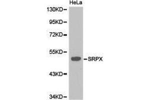 Western Blotting (WB) image for anti-Sushi-Repeat Containing Protein, X-Linked (SRPX) antibody (ABIN1874945)