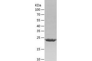Western Blotting (WB) image for RAB27B, Member RAS Oncogene Family (RAB27B) (AA 1-218) protein (His tag) (ABIN7284221) (RAB27B Protein (AA 1-218) (His tag))