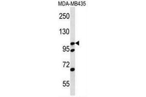 CTNND2 Antibody (C-term) western blot analysis in MDA-MB435 cell line lysates (35µg/lane). (CTNND2 antibody  (C-Term))