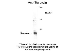Western blot of Anti-Stargazin (Rabbit) Antibody - 600-401-E32 Western Blot of Rabbit anti-Stargazin antibody.