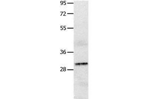 Western Blot analysis of A549 cell using IL2RA Polyclonal Antibody at dilution of 1:750 (CD25 antibody)