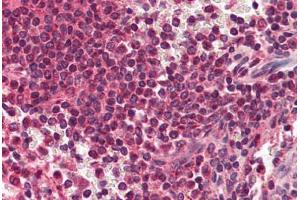 Human Spleen (formalin-fixed, paraffin-embedded) stained with RYBP antibody ABIN214470 at 2. (RYBP antibody  (AA 215-228))