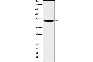 Western blot analysis of p60 CAF1 expression in Caco2 cell lysate. (Recombinant CHAF1B antibody)