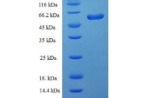 SDS-PAGE (SDS) image for Chitinase 3-Like 2 (CHI3L2) (AA 27-390) protein (His-SUMO Tag) (ABIN5711239) (CHI3L2 Protein (AA 27-390) (His-SUMO Tag))