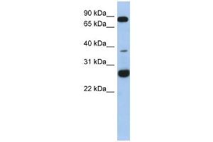 C1ORF110 antibody used at 1 ug/ml to detect target protein. (C1ORF110 antibody  (N-Term))