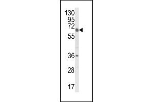 Western blot analysis of CYP2C18 Antibody (C-term) (ABIN652672 and ABIN2842450) in HL-60 cell line lysates (35 μg/lane). (CYP2C18 antibody  (C-Term))