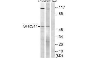 Western blot analysis of extracts from LOVO cells and RAW264. (SRSF11 antibody)