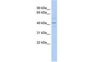 Image no. 1 for anti-Wingless-Type MMTV Integration Site Family Member 2 (WNT2) (AA 143-192) antibody (ABIN6742253)