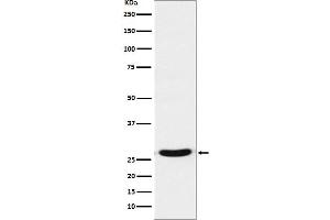 Western blot analysis of TCF21 expression in 293 cell lysate.